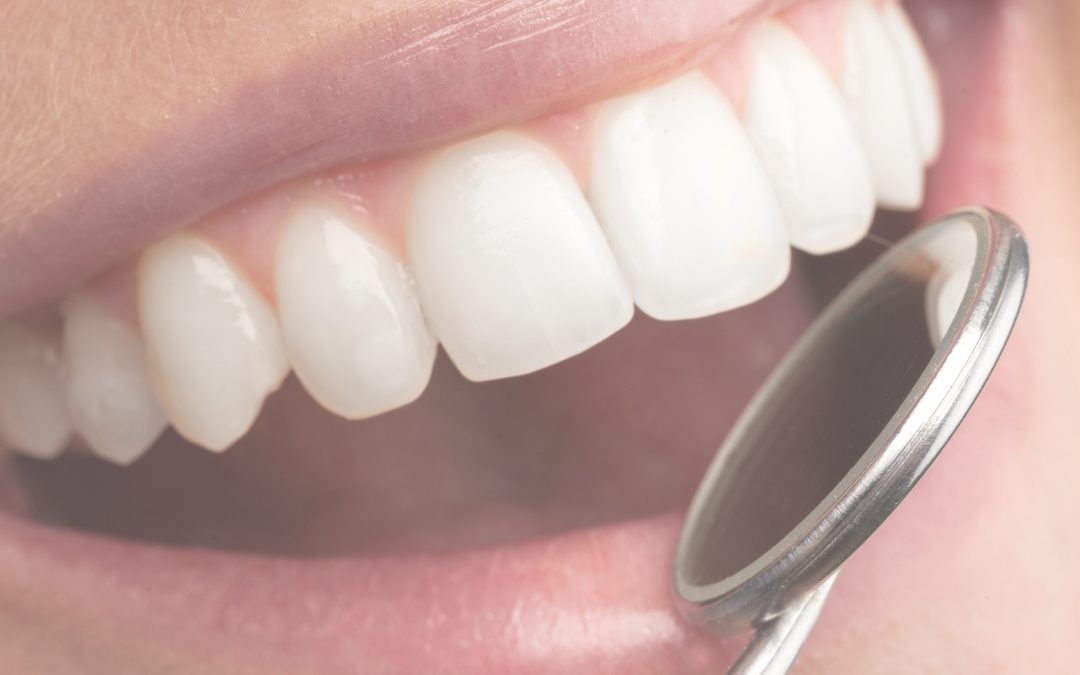 Diferencia entre limpieza dental y raspado