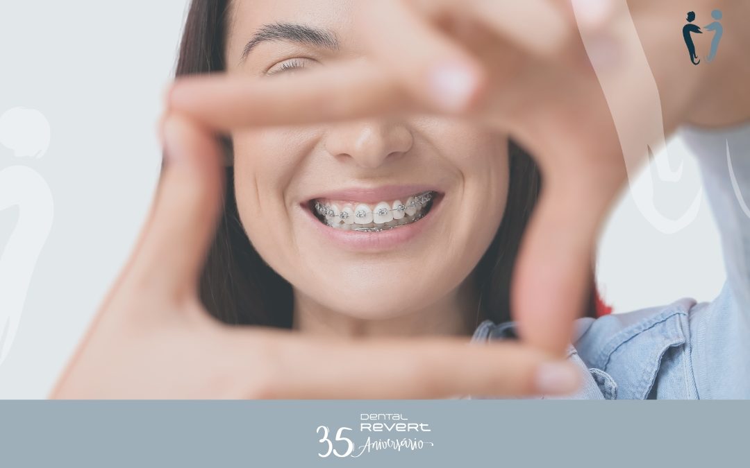 Cómo la ortodoncia beneficia tu salud bucal